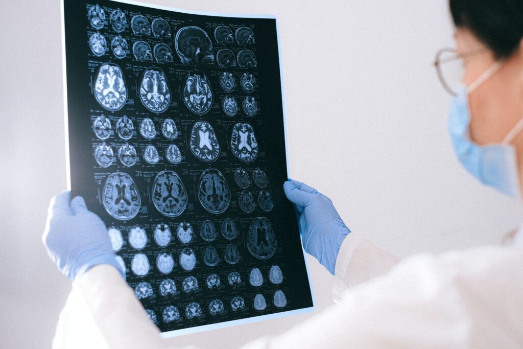 identifying concussions, whiplash and head injuries